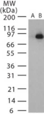 Western Blot: Anthrax LF Antibody [NB100-56666]