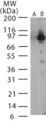 Western Blot: Anthrax LF Antibody [NB100-56667]