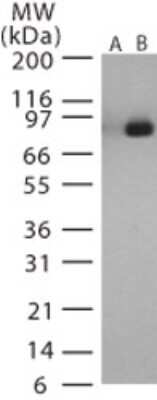 Western Blot: Anthrax LF Antibody [NB100-56668]