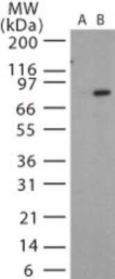 Western Blot: Anthrax PA Antibody [NB100-56670]