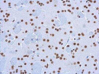 Immunohistochemistry-Paraffin: 5-hmC Antibody (13612) [NBP2-42219]
