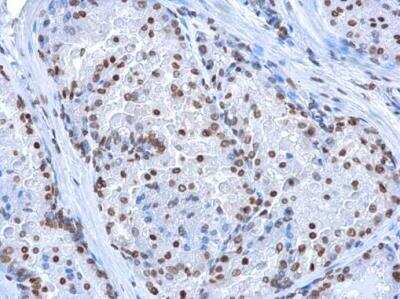 Immunohistochemistry-Paraffin: 5-hmC Antibody (13612) [NBP2-42219]