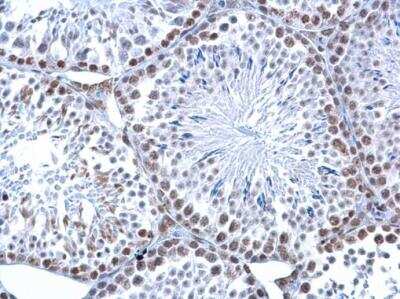 Immunohistochemistry-Paraffin: 5-hmC Antibody (13612) [NBP2-42219]