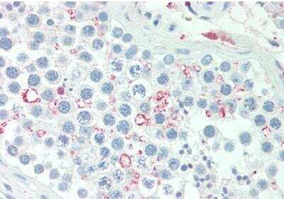 Immunohistochemistry-Paraffin: ADIG Antibody [NBP2-75311]