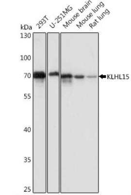 Western Blot: KLHL15 Antibody [NBP2-95268]