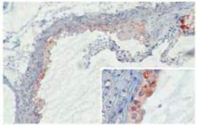 Immunohistochemistry-Frozen: MBL-2 Antibody (14D12) [NBP1-60128]