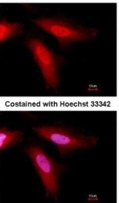 Immunocytochemistry/ Immunofluorescence: Serpin C1/Antithrombin-III Antibody [NBP2-15414]