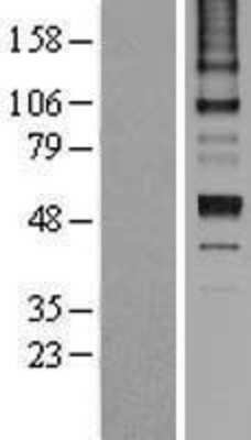 Western Blot: Serpin C1/Antithrombin-III Overexpression Lysate [NBL1-15852]