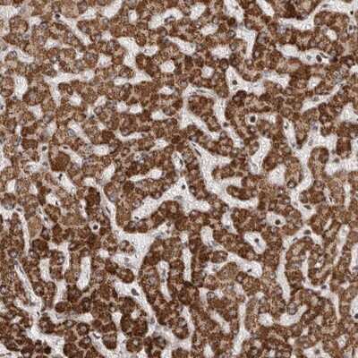 Immunohistochemistry-Paraffin: Antizyme inhibitor 1 Antibody [NBP1-82497]