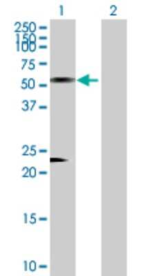 Western Blot: Antizyme inhibitor 1 Antibody [H00051582-D01P]