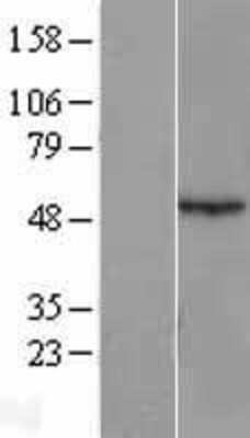 Western Blot: Antizyme inhibitor 1 Overexpression Lysate [NBL1-07872]