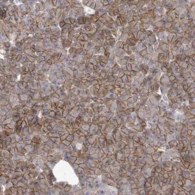 Immunohistochemistry: Apc1 Antibody [NBP2-37880]