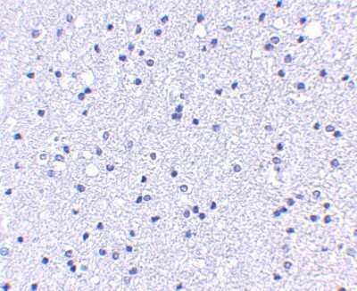 Immunohistochemistry-Paraffin: Apc1 Antibody - BSA Free [NBP1-77375]