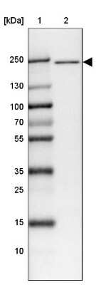 Western Blot: Apc1 Antibody [NBP1-90141]