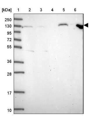 Western Blot: Apc1 Antibody [NBP2-37901]