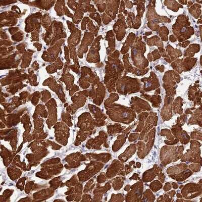 Immunohistochemistry-Paraffin: Apc10 Antibody [NBP2-14291]
