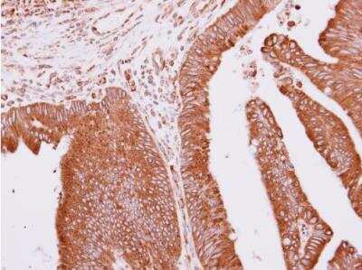 Immunohistochemistry-Paraffin: Apc10 Antibody [NBP2-15423]