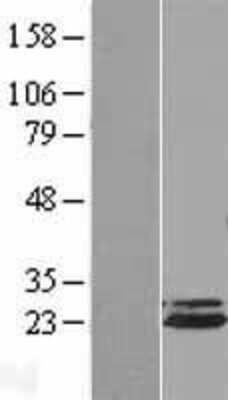 Western Blot: Apc10 Overexpression Lysate [NBL1-07512]