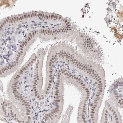 Immunohistochemistry-Paraffin: Apc11 Antibody [NBP1-90139]