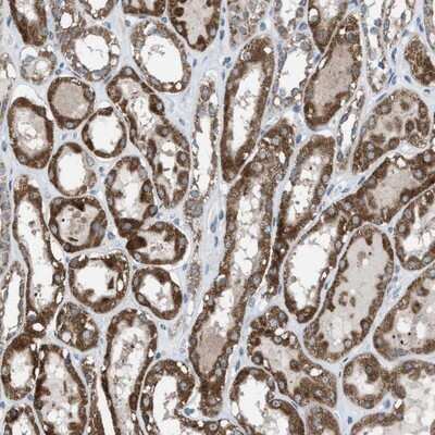 Immunohistochemistry-Paraffin: Apc11 Antibody [NBP1-90140]