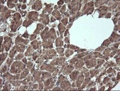 Immunohistochemistry: Apc11 Antibody (OTI3F5) [NBP2-45493]