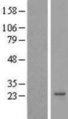 Western Blot: Apc11 Overexpression Lysate [NBL1-07513]