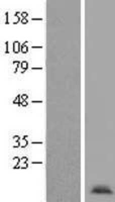 Western Blot: Apc11 Overexpression Lysate [NBL1-07514]