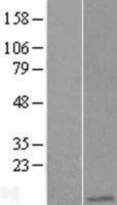 Western Blot: Apc11 Overexpression Lysate [NBP2-07033]