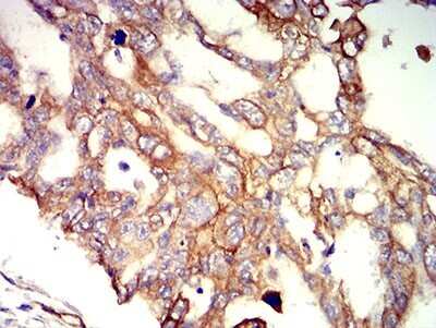 Immunohistochemistry: Apc2 Antibody (3A2G2) - BSA Free [NBP2-61656]