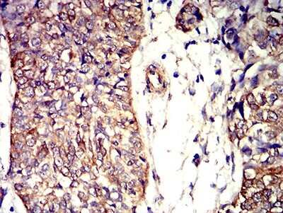 Immunohistochemistry: Apc2 Antibody (3A2G2) - BSA Free [NBP2-61656]