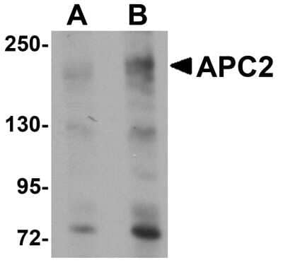 Western Blot: Apc2 AntibodyBSA Free [NBP1-77376]