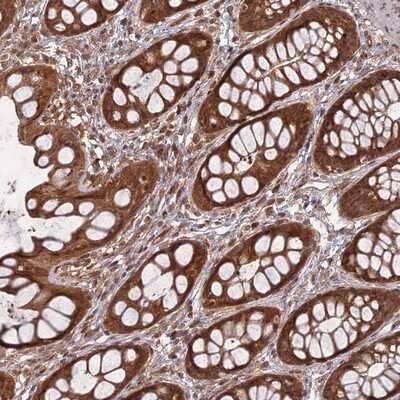 Immunohistochemistry-Paraffin: Apc4 Antibody [NBP1-90138]