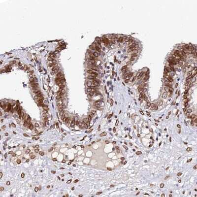 Immunohistochemistry-Paraffin: Apc5 Antibody [NBP1-90136]