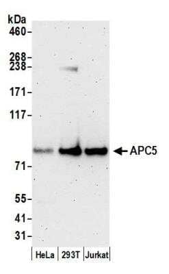 Western Blot: Apc5 Antibody [NB100-55319]