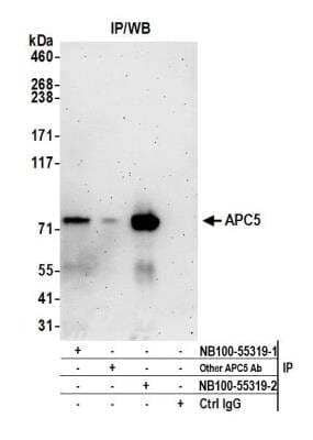 Immunoprecipitation: Apc5 Antibody [NB100-55319]