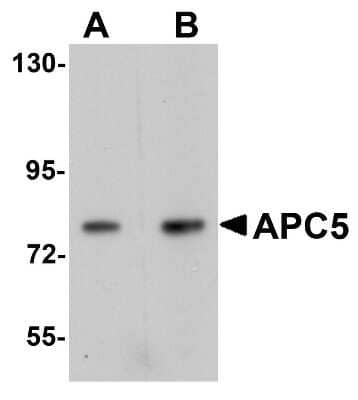 Western Blot: Apc5 AntibodyBSA Free [NBP1-77154]