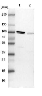 Western Blot: Apc5 Antibody [NBP1-90136]