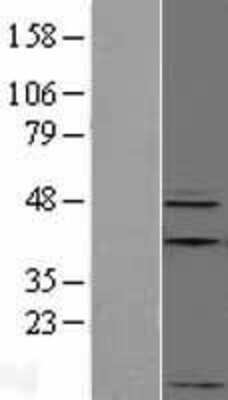 Western Blot: Apelin Overexpression Lysate [NBL1-07605]