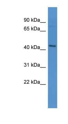 Western Blot: APJ/Apelin receptor Antibody [NBP1-68946]