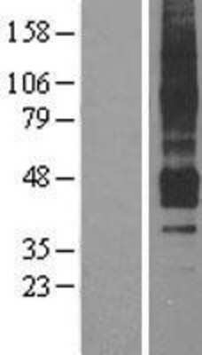 Western Blot: APJ/Apelin receptor Overexpression Lysate [NBL1-07606]