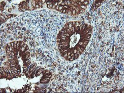 Immunohistochemistry-Paraffin: ATG3/APG3 Antibody (OTI3H2) [NBP2-01083]