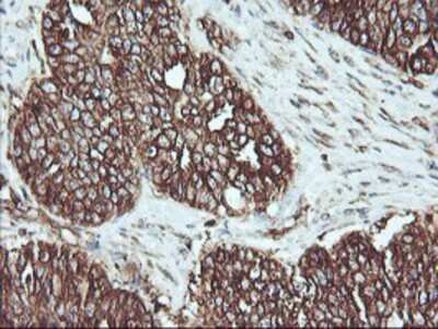 Immunohistochemistry-Paraffin: ATG3/APG3 Antibody (OTI3H2) [NBP2-01083]