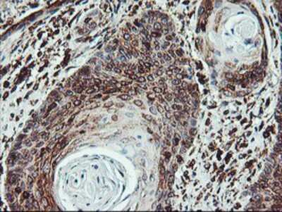 Immunohistochemistry-Paraffin: ATG3/APG3 Antibody (OTI3H2) [NBP2-01083]