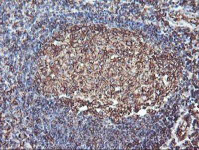Immunohistochemistry-Paraffin: ATG3/APG3 Antibody (OTI3H2) [NBP2-01083]