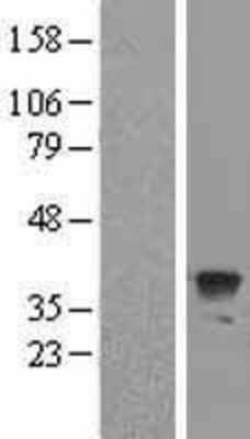 Western Blot: ATG3/APG3 Overexpression Lysate [NBL1-07796]