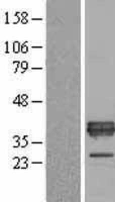 Western Blot: Apolipoprotein E/ApoE Overexpression Lysate [NBL1-07621]