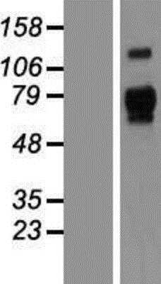 Western Blot: Apolipoprotein E R2/ApoE R2 Overexpression Lysate [NBP2-06973]