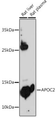 Western Blot: Apolipoprotein C-II/ApoC2 AntibodyBSA Free [NBP2-92374]