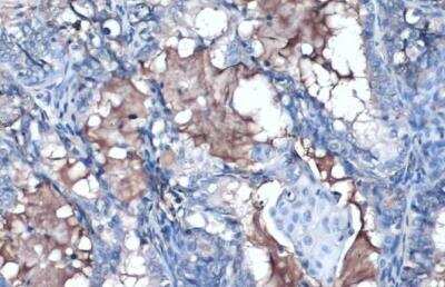 Immunohistochemistry-Paraffin: Apolipoprotein A-I/ApoA1 Antibody [NBP2-15429]