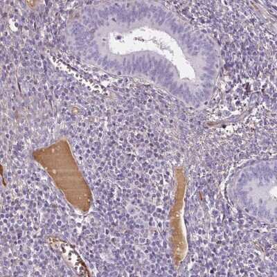 Immunohistochemistry-Paraffin: Apolipoprotein A-I/ApoA1 Antibody [NBP2-33468]